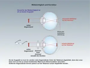 Mensch-Auge-3